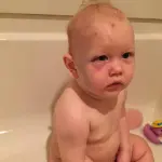 Oregon: baby sitter picchia bimbo, livido a forma di mano sul volto