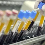 Tumore al rene annientato con immuno-oncologia