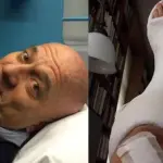 Claudio Bisio con gamba ingessata dopo incidente in moto