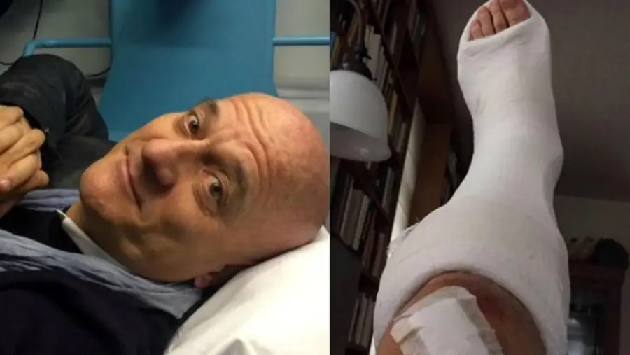 Claudio Bisio con gamba ingessata dopo incidente in moto