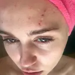Miley Cyrus ferita da un gatto: foto su Instagram