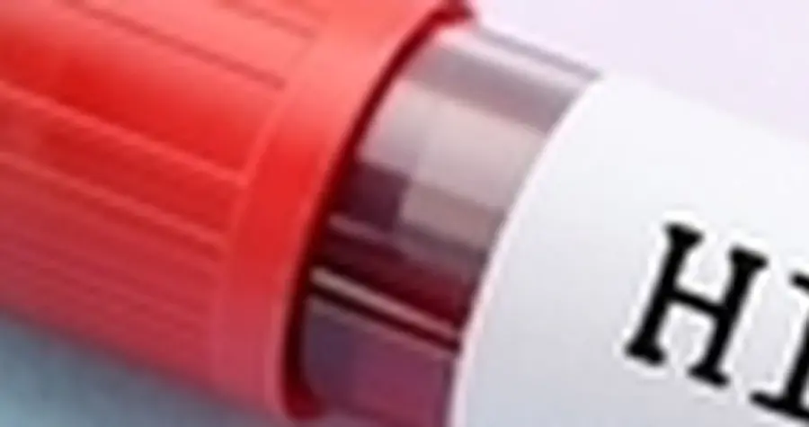 Untore Roma Confessa Rapporto non Protetto con Minorenne