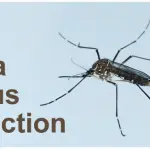 Virus Zika piega Brasile: boom casi microcefalia neonatale