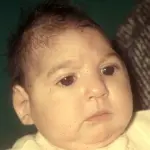 Microcefalia causata da virus Zika: Brasile trema