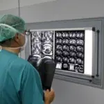 Tumori: biochip purifica sangue ed evita metastasi. Viatico per diagnosi