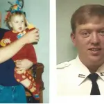 Trapianto Completo di Tessuto Facciale: Intervento di 26 Ore Costato un Milione di Dollari