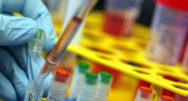 Batteri Resistenti, Abuso Antibiotici E' Deleterio: Italiani Avvisati!