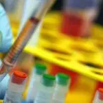Batteri Resistenti, Abuso Antibiotici E' Deleterio: Italiani Avvisati!