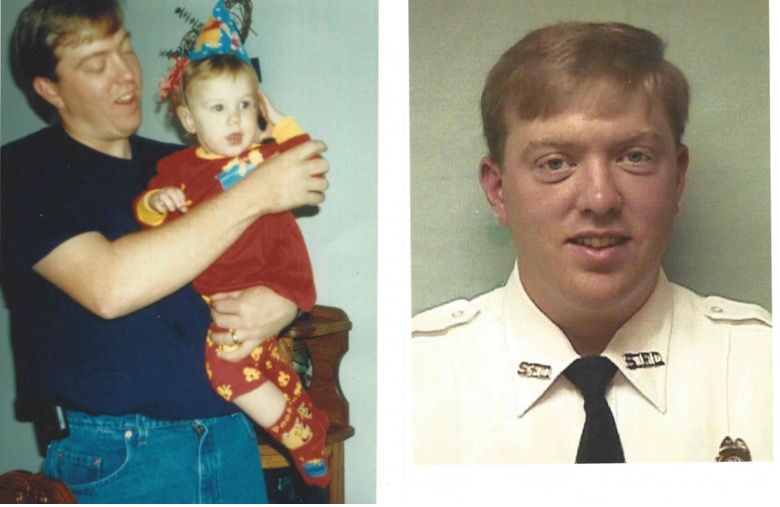 Trapianto Completo di Tessuto Facciale: Intervento di 26 Ore Costato un Milione di Dollari