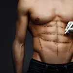 Liposuzione, interventi sugli uomini in crescita: ecco come e quando farla