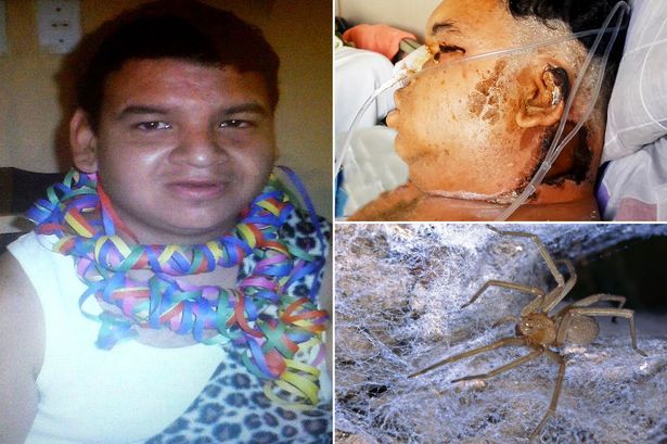 Perù, Ragno Velenoso lo Punge in Bagno: Orlando Rischia Morte