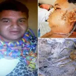 Perù, Ragno Velenoso lo Punge in Bagno: Orlando Rischia Morte