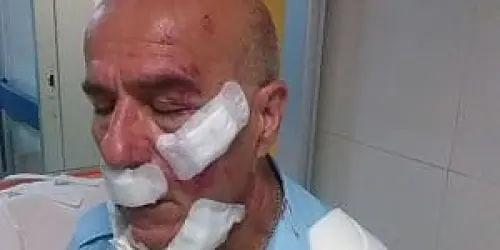 Roma, Autista Bus Trova Macchina Posteggiata in Doppia Fila e Suona: Picchiato