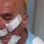 Roma, Autista Bus Trova Macchina Posteggiata in Doppia Fila e Suona: Picchiato