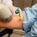 Inghilterra, Allerta Super Gonorrea: Boom Casi. Resistente agli Antibiotici
