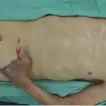 Per salvargli la mano, la cuciono nell'addome!