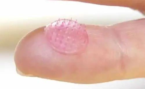 Vaccino antinfluenzale: cerotto soppianterà siringa, timorosi dell'ago esultano