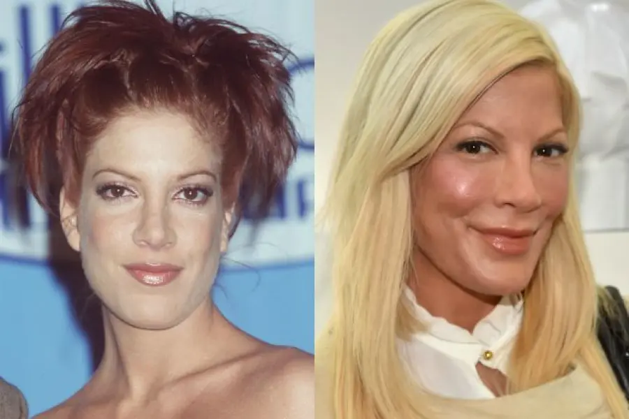 Tori Spelling rovinata dal botox: sguardo fisso e zigomi sporgenti