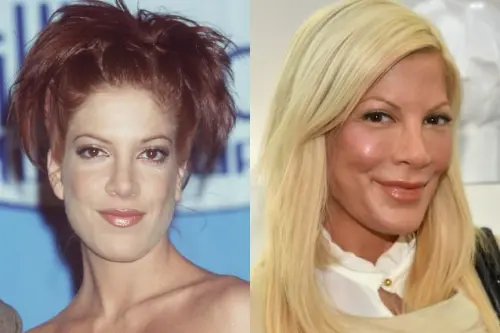 Tori Spelling rovinata dal botox: sguardo fisso e zigomi sporgenti