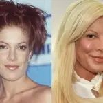 Tori Spelling rovinata dal botox: sguardo fisso e zigomi sporgenti