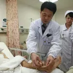 Cina, lama rotante gli trancia mano: arto impiantato nella gamba