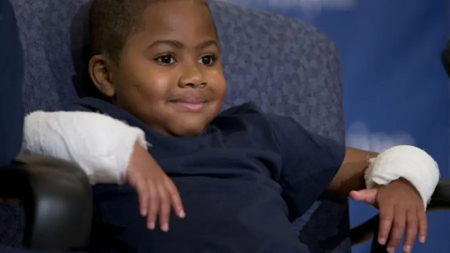 Trapianto di mani su bimbo: Zion Harvey è felice