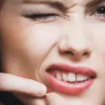 Acne: vitamina B12 sotto accusa, stimola Propionibacterium acnes