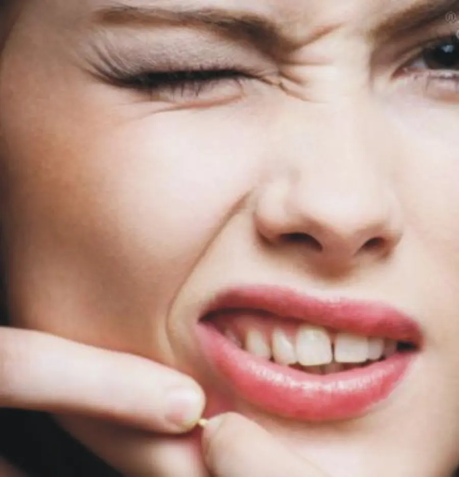 Acne: vitamina B12 sotto accusa, stimola Propionibacterium acnes