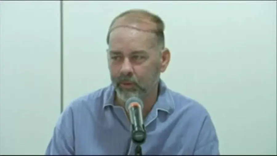 Texas, primo trapianto di cranio e cuoio capelluto al mondo: intervento durato 15 ore