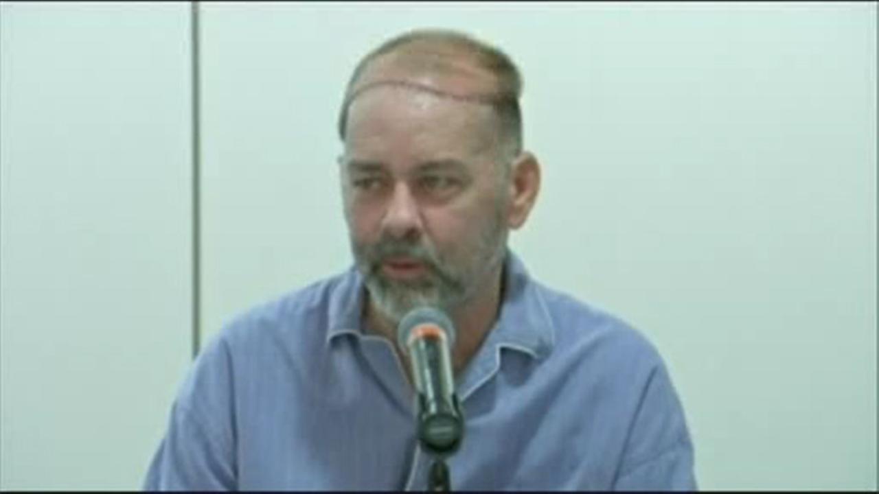 Texas, primo trapianto di cranio e cuoio capelluto al mondo: intervento durato 15 ore