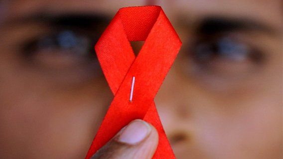 Ecco la 'porta' dell'Hiv: Dna virus finisce nella periferia del nucleo