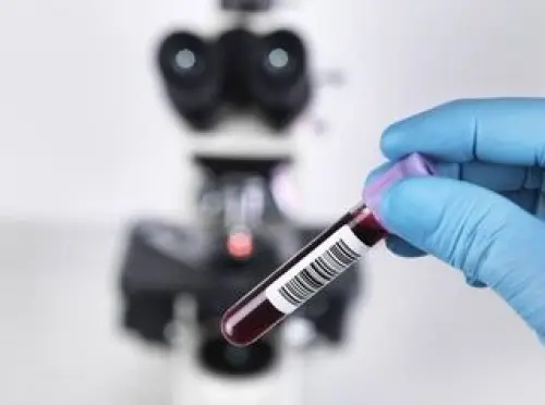 Hiv, vaccino italiano portentoso: energizza sistema immunitario