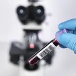Hiv, vaccino italiano portentoso: energizza sistema immunitario