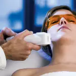 Depilazione laser, gli errori da evitare