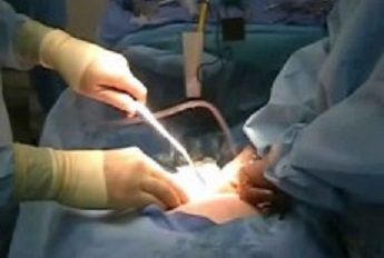 Ricoverato per operazione ai reni, si ritrova evirato per errore