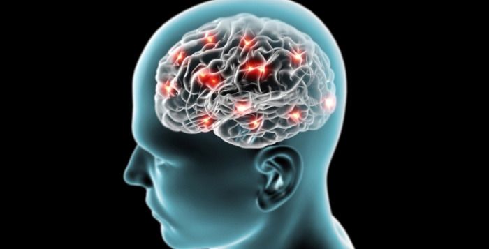 Alzheimer, ultrasuoni per curarlo: terapia efficace nel 75% dei casi