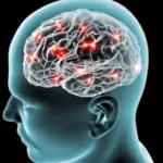 Alzheimer, ultrasuoni per curarlo: terapia efficace nel 75% dei casi
