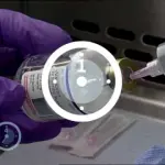 Tumore al pancreas: Abraxane incassa ok Aifa, colpisce neoplasia al cuore