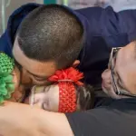 Texas, gemelle siamesi separate: condividevano pancia e petto