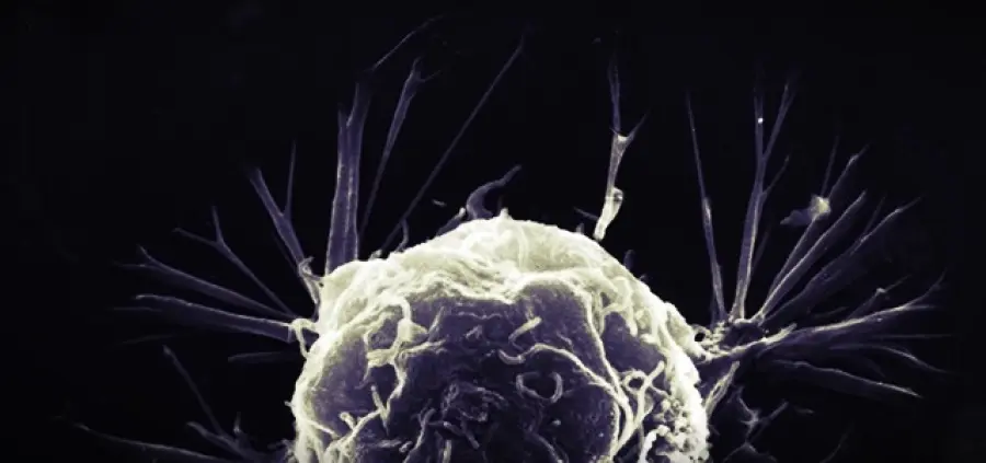 Tumore è questione di sfortuna: studio choc contestato da comunità scientifica
