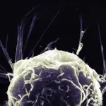 Tumore è questione di sfortuna: studio choc contestato da comunità scientifica