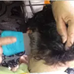 Scorribande di pidocchi sulla testa di una bimba: video diventa virale