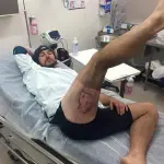 iPhone esplode: ciclista ustionato