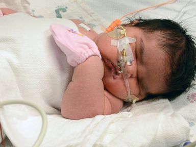 India, Parto Record: Neonato Pesa Quasi 6 Kg