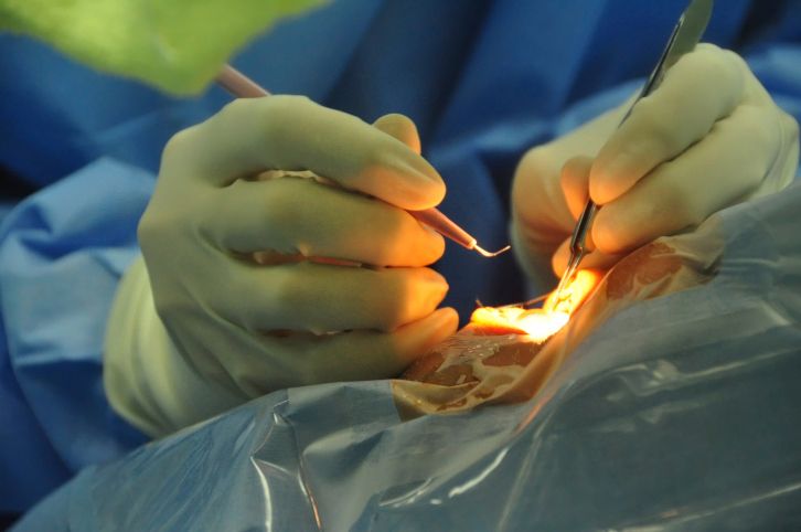 La cataratta va curata: l'intervento chirurgico è necessario per evitare la cecità