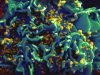 Hiv: italiani ignoranti su cause e terapie, sieropositivi ancora discriminati